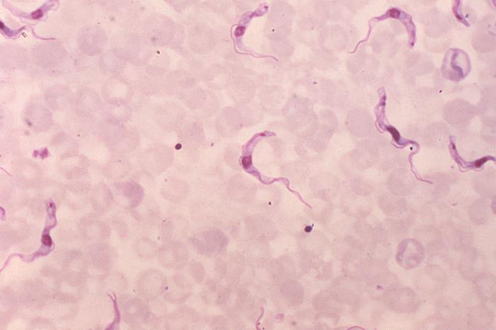 File:African trypanosomiasis06.jpeg