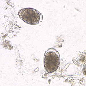 Eggs of D. latum in an unstained wet mount of stool. Note the opercula are open. Adapted from CDC