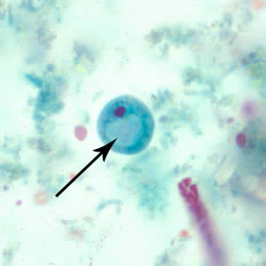 Cyst of I. buetschlii stained with trichrome. In this specimen, both the nucleus and large glycogen vacuole are visible (arrow). Adapted from CDC