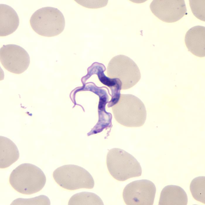 File:African trypanosomiasis01.jpg