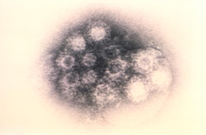 Transmission electron micrograph (TEM) depicts a number of virions found responsible for a case of acute hemorrhagic conjunctivitis (AHC). From Public Health Image Library (PHIL). [27]