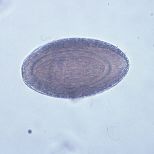 Egg of M. hirudinaceous in an unstained wet mount of stool. Adapted from CDC