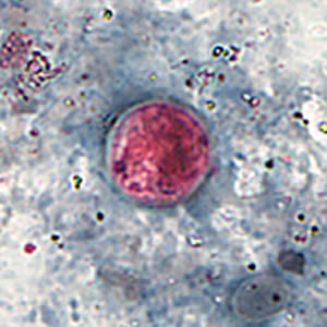 Oocyst of C. cayetanensis stained with safranin (SAF). Adapted from CDC