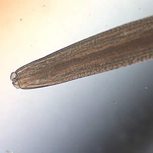 Anterior ends of Pseudoterranova sp. worms; images taken at 40x and 200x magnification, respectively. Adapted from CDC