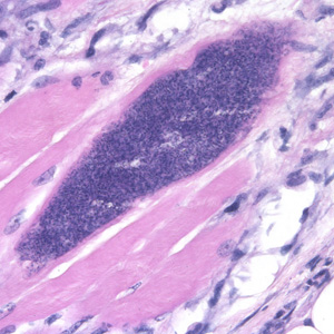 File:Sarcocystis 500x1 muscle.jpg