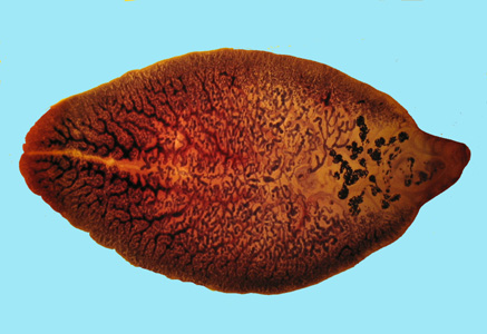 File:F hepatica adult stained BAM.jpg