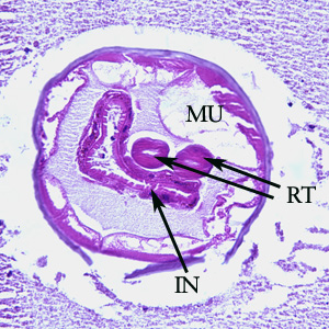 Cross-section of an adult of Oesophagostomum sp. in a colon biopsy specimen from a patient from Africa, stained with hematoxylin and eosin (H&E). Note the large, platymyarian muscle cells (MU), intestine with brush border (IN), paired reproductive tubes (RT). This image is taken at 200x magnification.