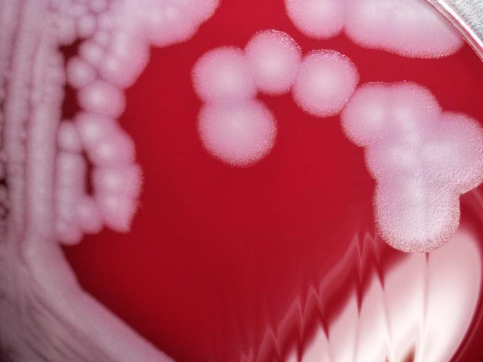 Low-power magnification of 5X of a digital Keyence scope, this photograph depicts the colonial growth displayed by Pasteur strain members of the Gram-positive bacterium, Bacillus anthracis, which were cultured on sheep blood agar (SBA) medium, for a 24 hour time period, at a temperature of 37°C.”Adapted from Public Health Image Library (PHIL), Centers for Disease Control and Prevention.[21]