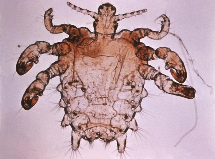 File:Pthius pubis - crab louse.jpg