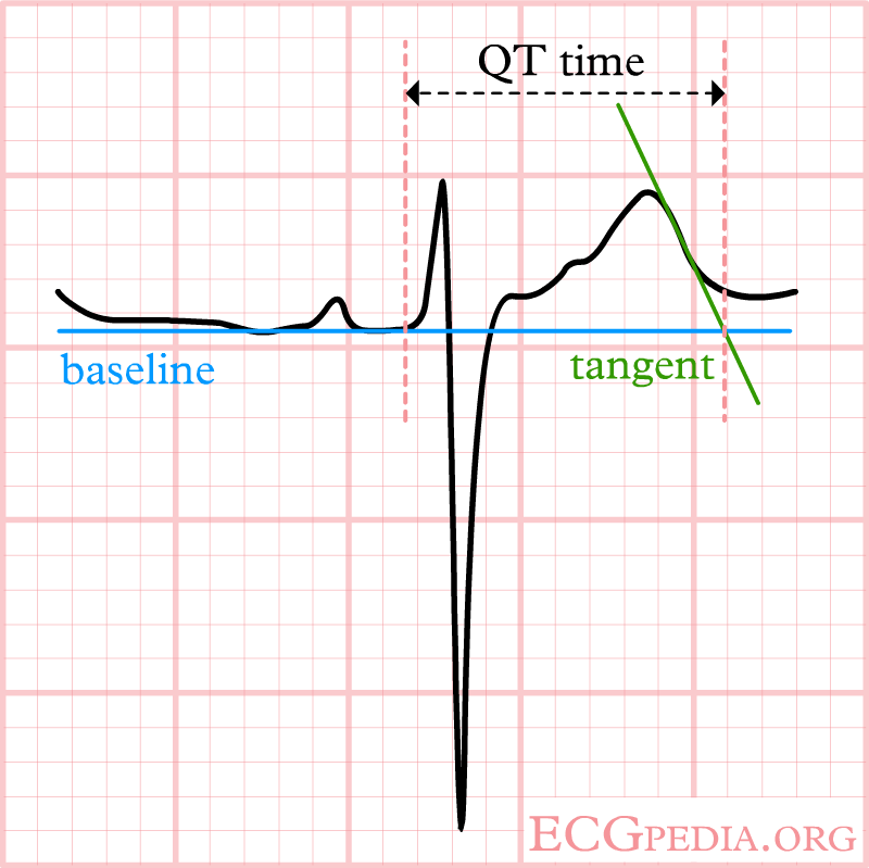 The ECG does not meet the baseline after the end of the T wave. Still, the crossing of the tangent and baseline should be used for measurements.
