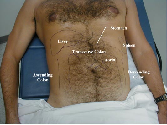 Topical Anatomy of the Abdomen.