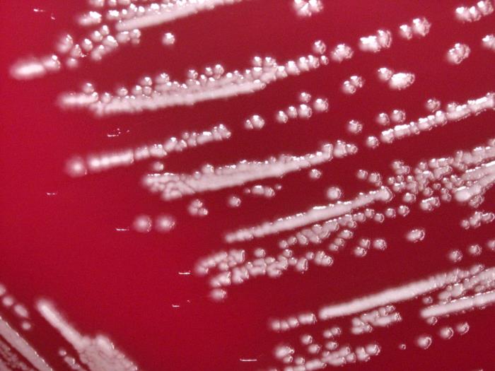 Yersinia pestis bacteria cultured on sheep blood agar (SBA) 48hrs (10x). Adapted from Public Health Image Library (PHIL), Centers for Disease Control and Prevention.[6]