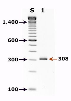 File:Cyclospora PCR.jpg