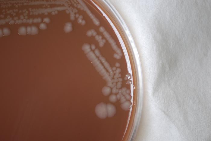 Colonial morphology displayed by Gram-negative Burkholderia mallei bacteria, grown on a medium of chocolate agar. From Public Health Image Library (PHIL). [3]