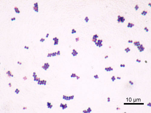 Gram stain of S. aureus