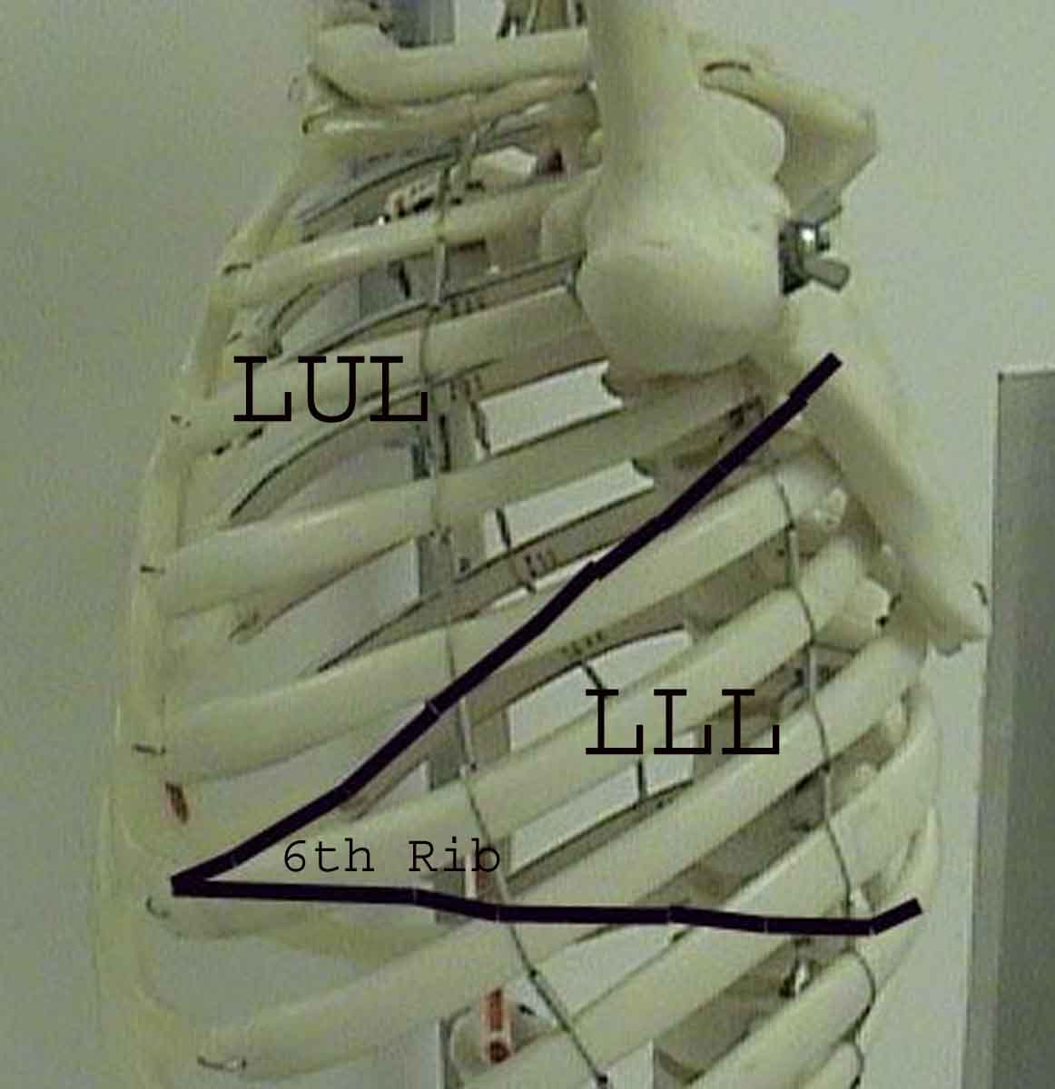 Lung thorax lline.jpg
