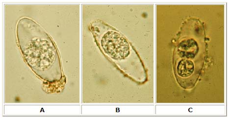 Oocysts of Isospora belli