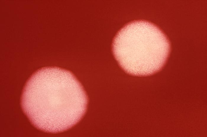This 1972 photograph depicts two Bacteroides fragilis subsp. fragilis bacterial cultures grown on blood agar medium for 48 hours. From Public Health Image Library (PHIL). [8]