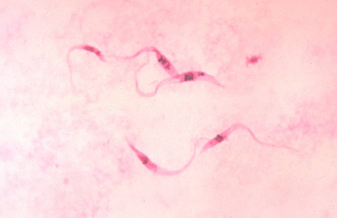 Trypanosoma cruzi parasites