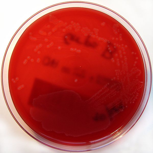 File:GBS on Columbia Horse blood agar.jpg