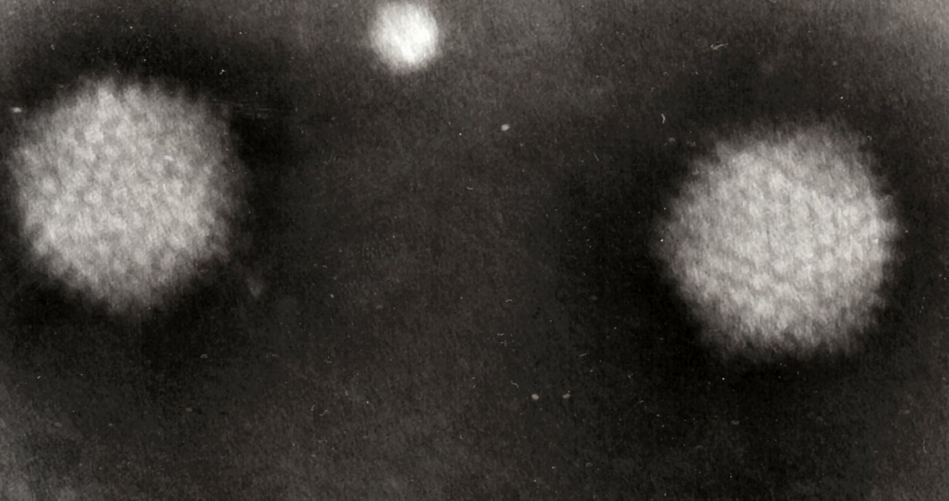 Transmission electron micrograph of two adenovirus particles