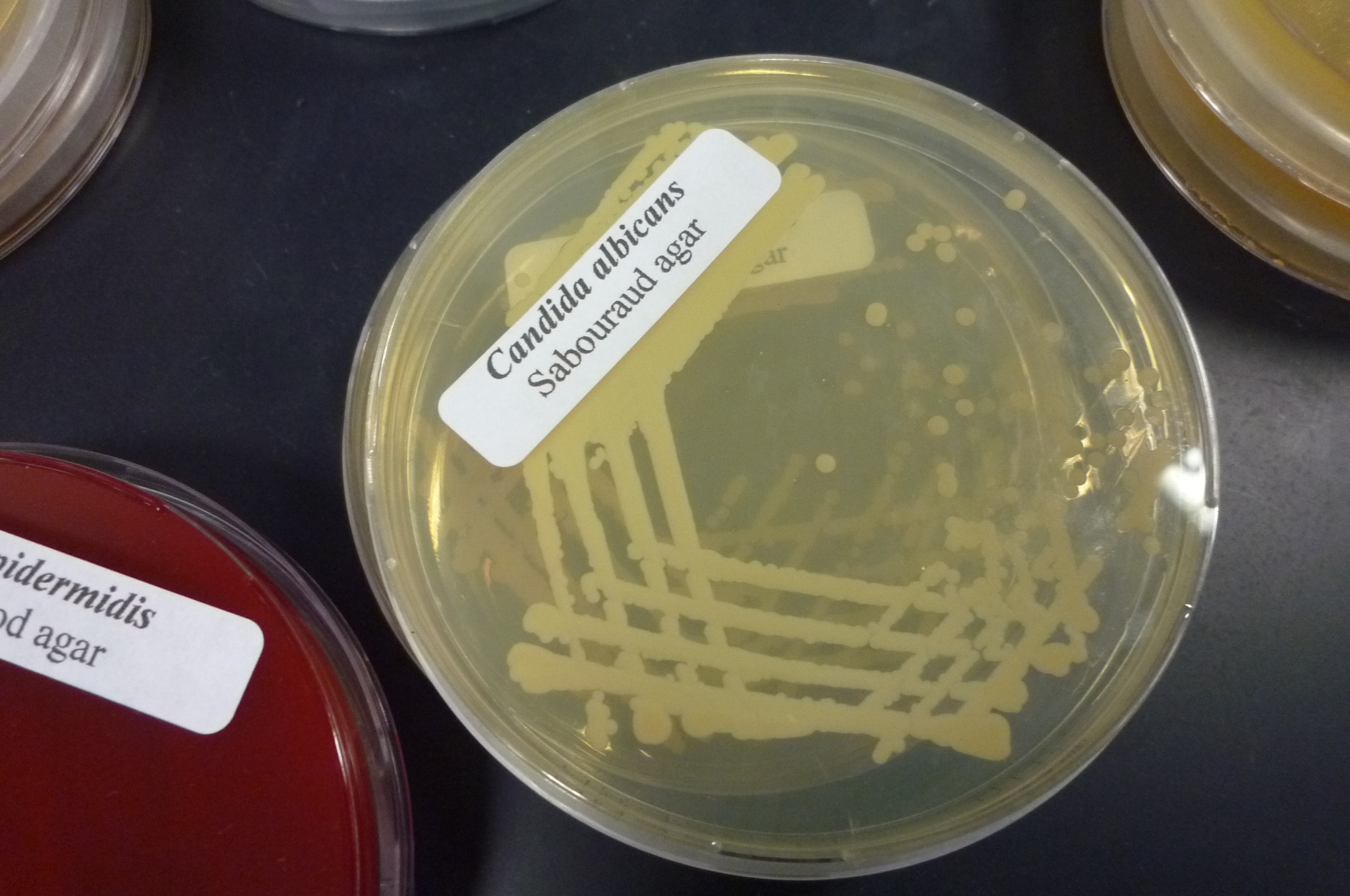 File:Candida albicans on Sabaroud agar medium - By Sun14916 - Own work, CC BY-SA 3.0, httpscommons.wikimedia.orgwindex.phpcurid=18864149.jpg