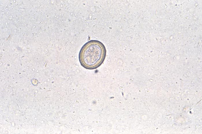 Photomicrograph depicts some of the ultrastructural details exhibited by a Taenia sp. ovum, i.e., egg (400X mag). From Public Health Image Library (PHIL). [2]