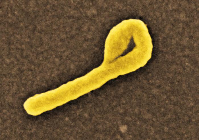 File:Ebolavirus04.jpeg