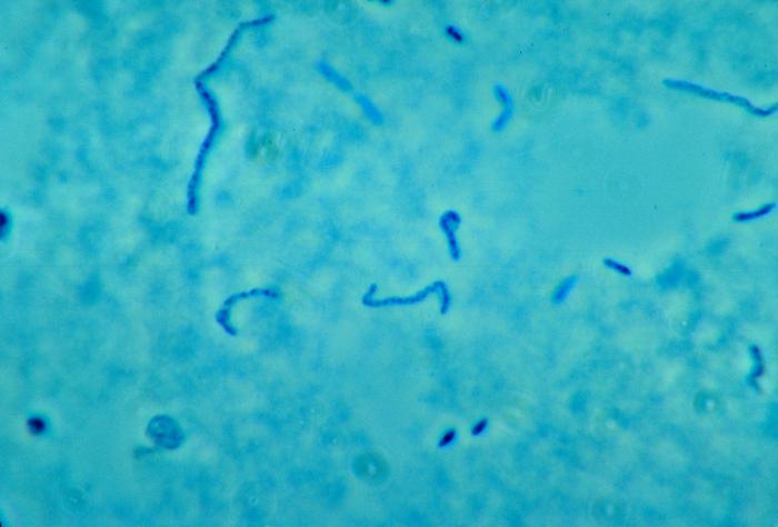 Phase-contrast photomicrographic image of Fusobacterium necrophorum. From Public Health Image Library (PHIL). [10]