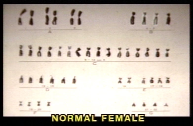 Karyotype of normal female.