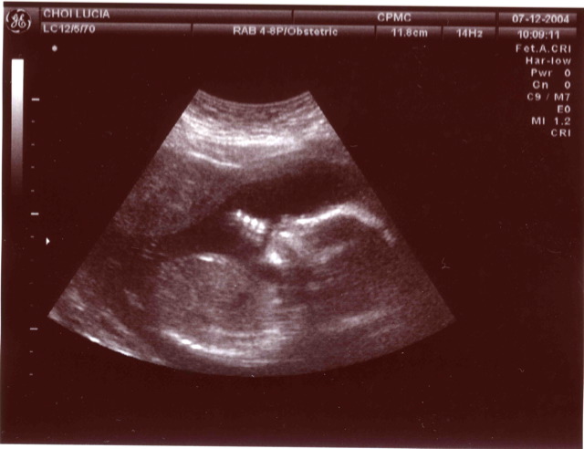 Baby in ultrasound.jpg
