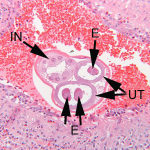 Higher magnification of the specimen in Figure A. Notice the thick, multinucleate intestine (IN) and eggs (EG) within the uterus (UT). Adapted from CDC