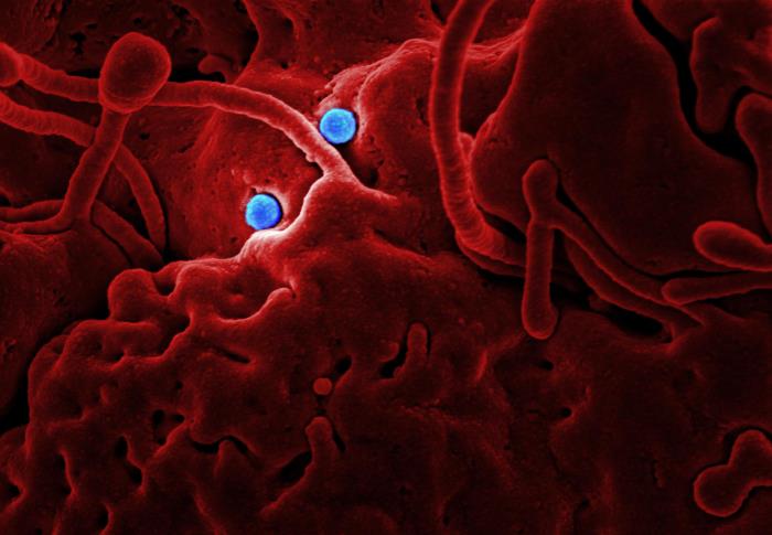 SEM reveals ultrastructural details at the site of interaction of two spherical-shaped Middle East Respiratory Syndrome Coronavirus (MERS-CoV) viral particles, colorized blue, that were on the surface of a camel epithelial cell, colorized red. From Public Health Image Library (PHIL). [16]