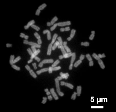 Human chromosomes during metaphase.