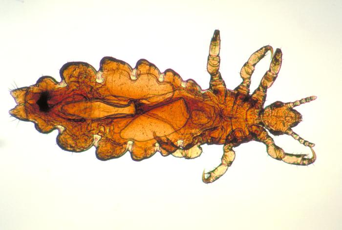 Image depicts a dorsal view of a female head louse, Pediculus humanus var. capitis. From Public Health Image Library (PHIL). [1]