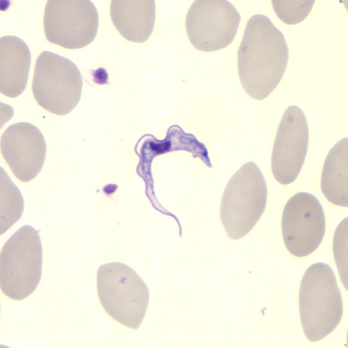 File:African trypanosomiasis02.jpeg