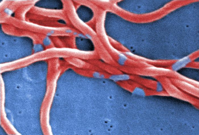 Under a high magnification, this digitally-colorized scanning electron micrograph depicts a grouping of Gram-negative, anaerobic, Borrelia burgdorferi bacteria, which had been derived from a pure culture. From Public Health Image Library (PHIL). [2]