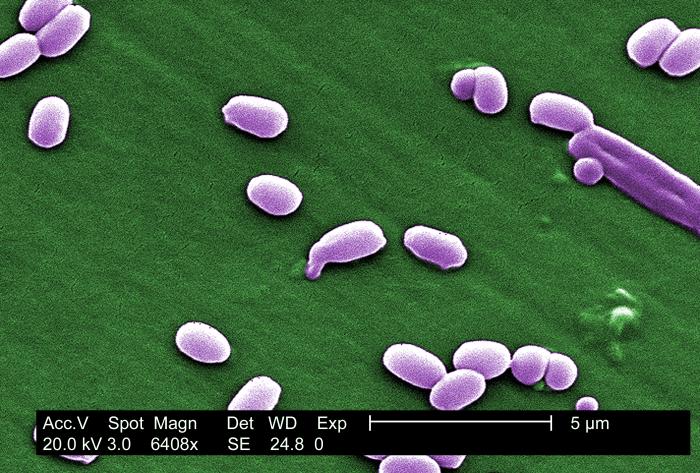Magnification of 6,408X, this scanning electron micrograph (SEM) depicted spores from the Aimes strain of Bacillus anthracis bacteria. ”Adapted from Public Health Image Library (PHIL), Centers for Disease Control and Prevention.[20]
