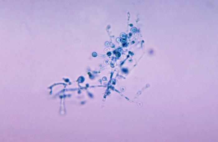 This is a photomicrograph of Blastomyces dermatitidis using a cotton blue staining technique. From Public Health Image Library (PHIL). [26]