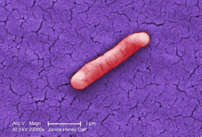 Gram-negative Salmonella typhimurium bacteria that had been isolated from a pure culture (20000X mag). From Public Health Image Library (PHIL). [18]