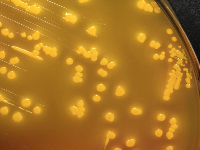 Gram-negative Yersinia pseudotuberculosis bacteria, cultured on a Hektoen enteric agar (HEK) medium 48hrs (10x mag). From Public Health Image Library (PHIL). [6]