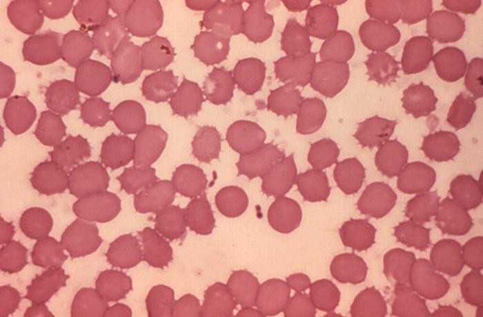 Blood smear reveals presence of Gram-negative Yersinia pestis plague bacteria. From Public Health Image Library (PHIL). [18]