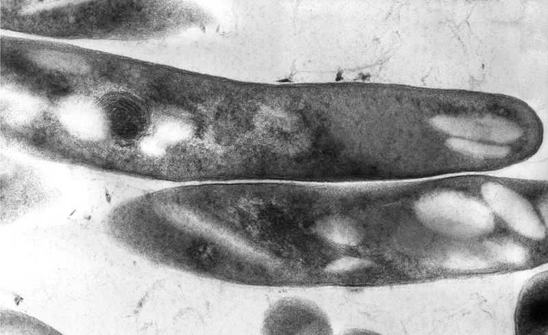 TEM micrograph of M. tuberculosis.