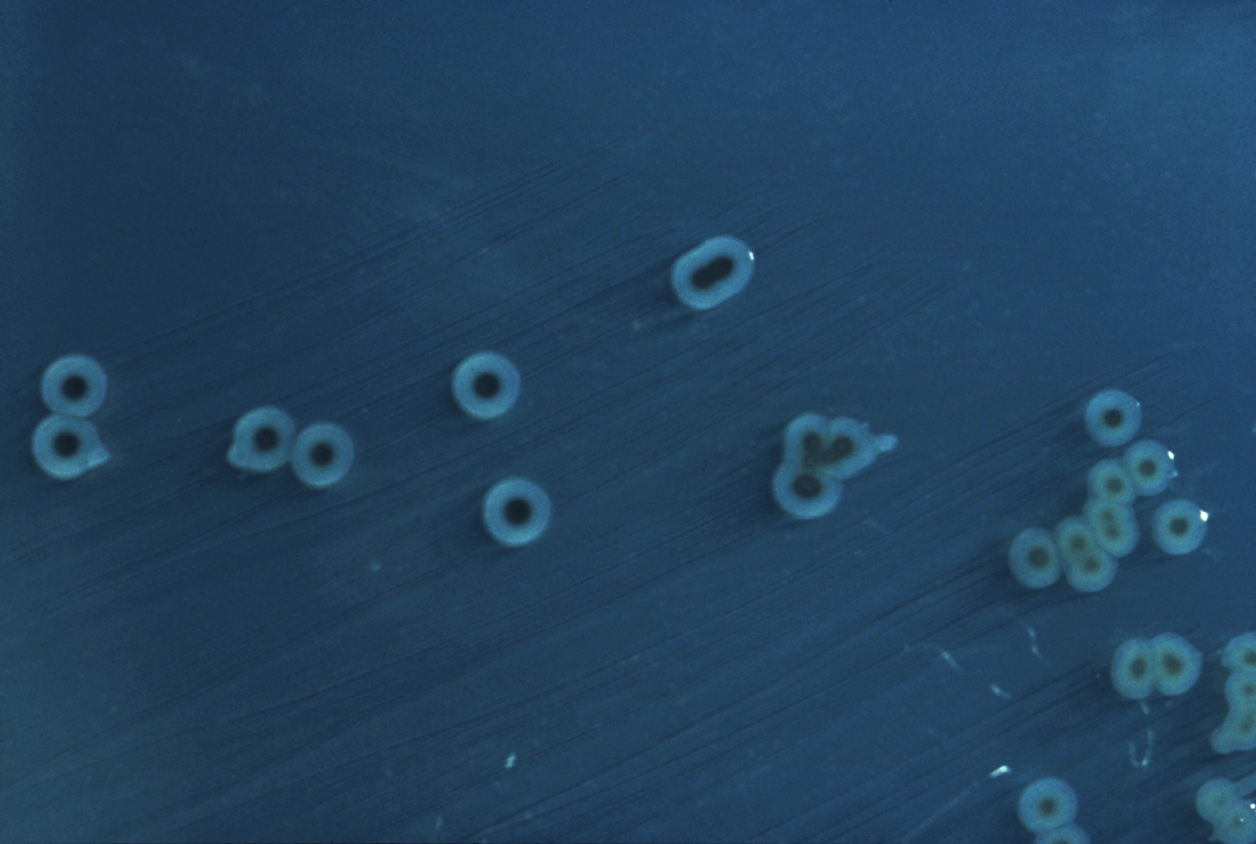 S. enterica Typhimurium colonies on a Hektoen enteric agar plate