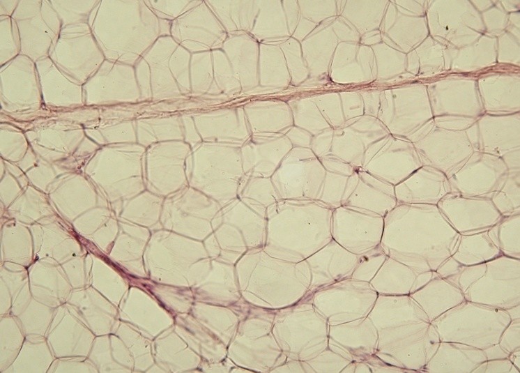 Yellow adipose tissue in paraffin section
