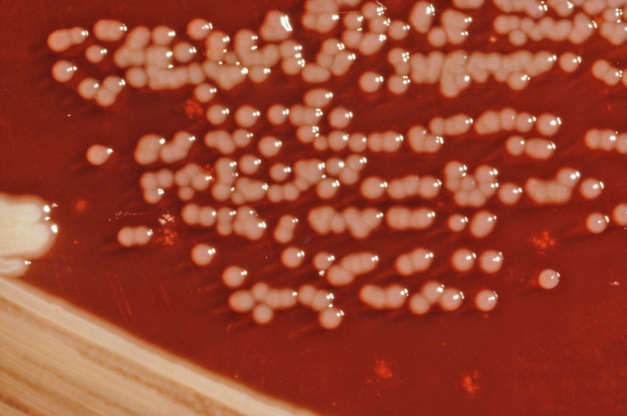 Yersinia enterocolitica colonies growing on XLD agar plates.
