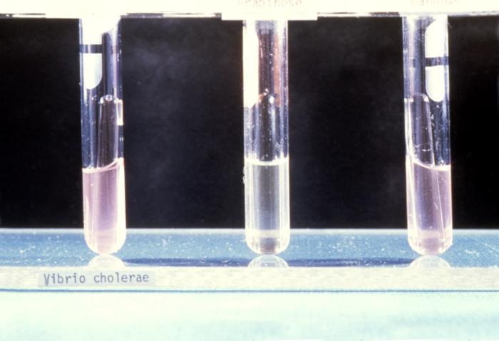 Heiberg Fermentation lab test used during the isolation and identification of Vibrio cholerae. From Public Health Image Library (PHIL). [9]