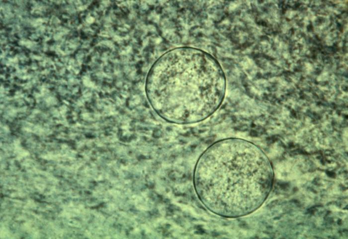 Smear of an exudate from an infected mouse, reveals spherules of Coccidioides immitis. From Public Health Image Library (PHIL). [5]