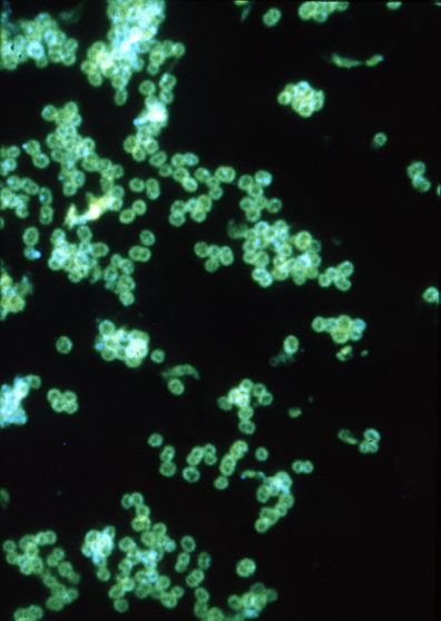Fluorescent antibody stain of Neisseria gonorrhoeae.