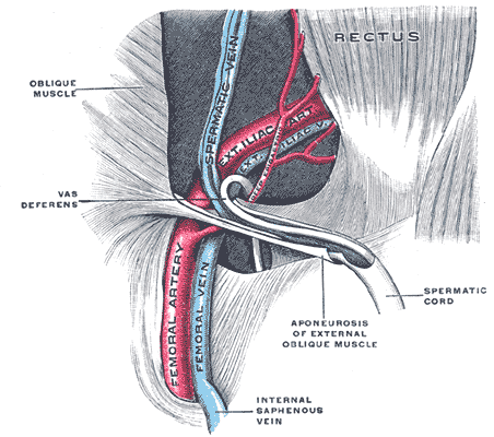 The spermatic cord in the inguinal canal.